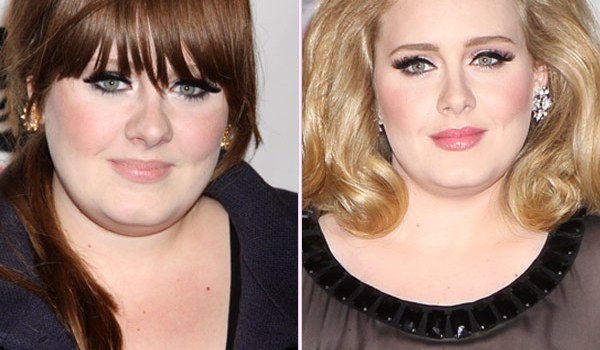 Adele Nose Job