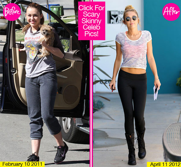 Miley Cyrus Anorexic