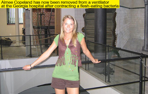 Aimee Copeland