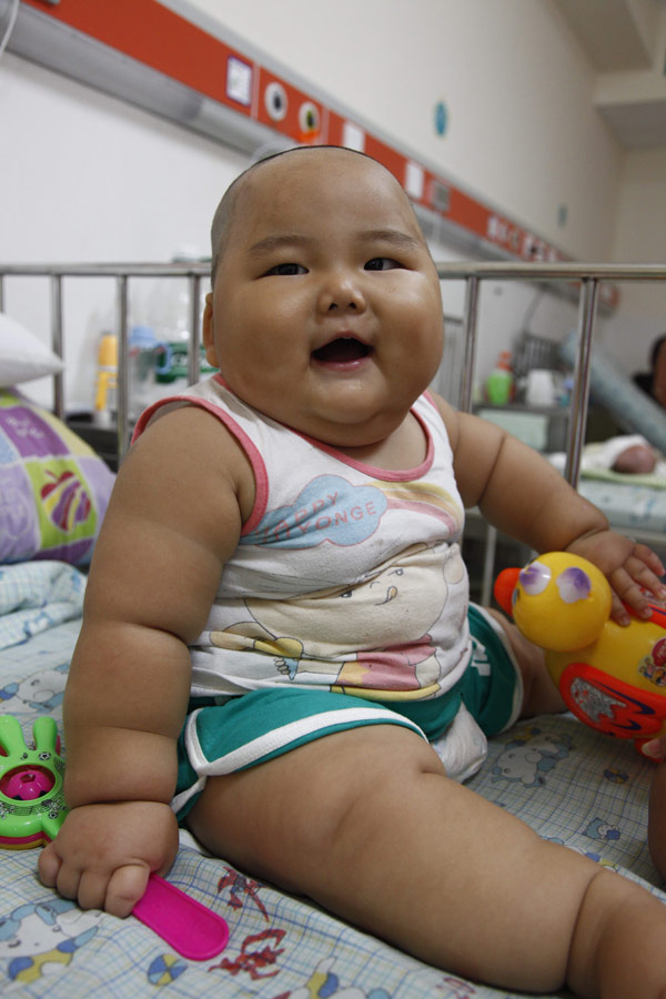 Overweight Children Life Expectancy