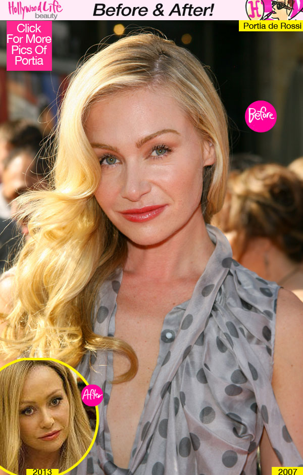 Portia De Rossi Plastic Surgery Before After