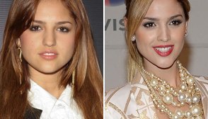 Eiza Gonzalez Plastic Surgery