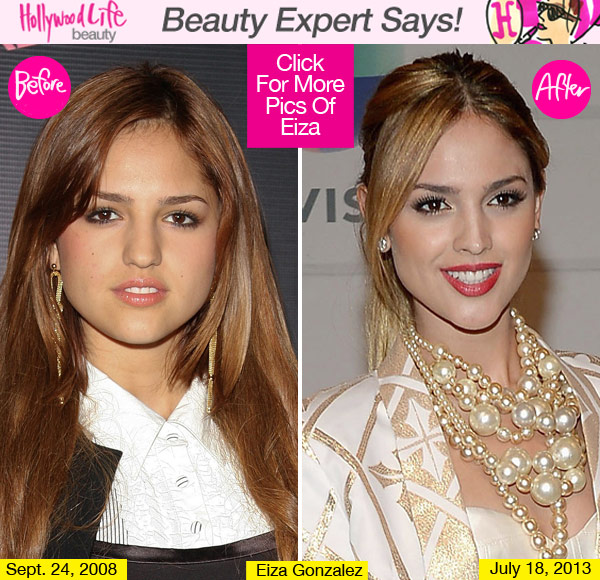 Eiza Gonzalez Plastic Surgery