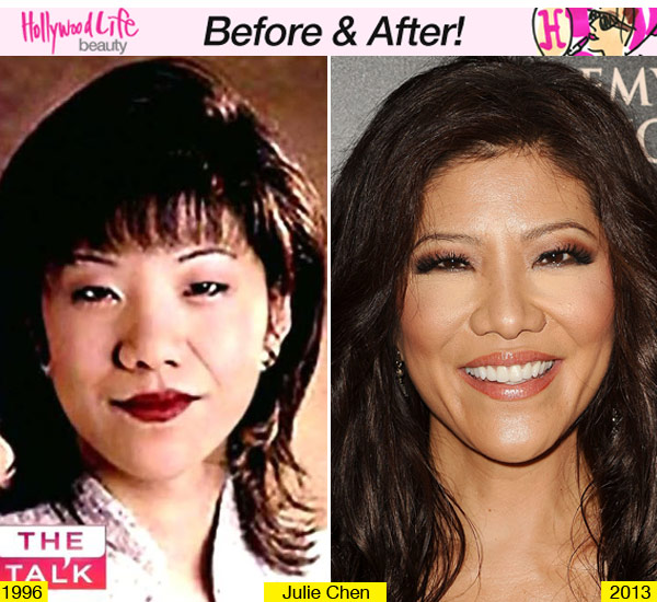 Julie Chen Plastic Surgery
