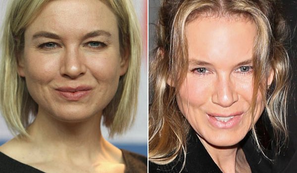 Renee Zellweger Face