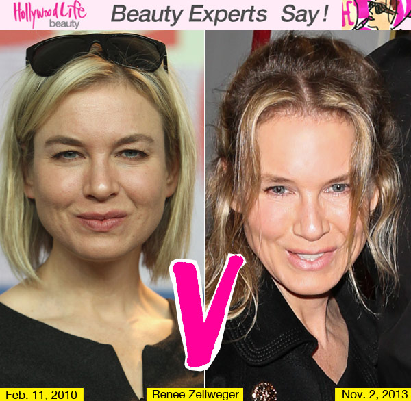 Renee Zellweger Face