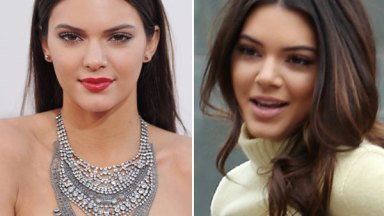 Kendall Jenner Nose Job