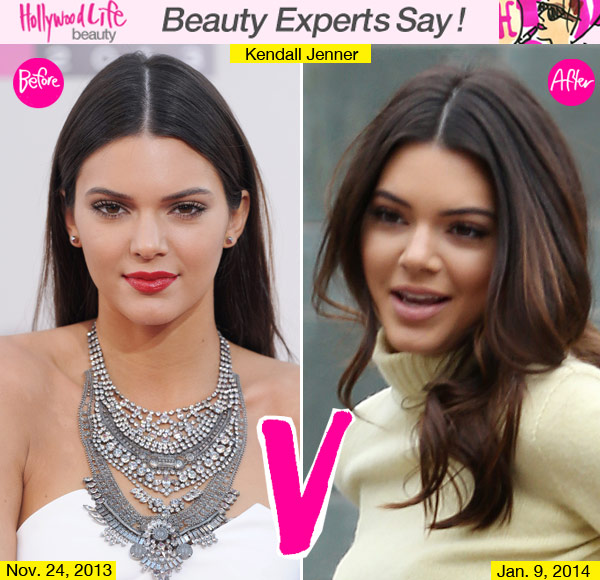 Kendall Jenner Nose Job