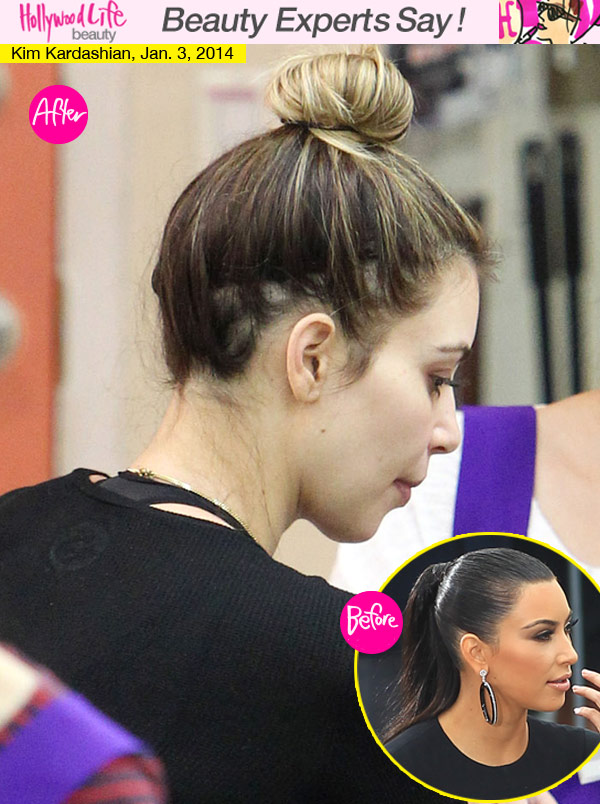Kim Kardashian Hair Loss