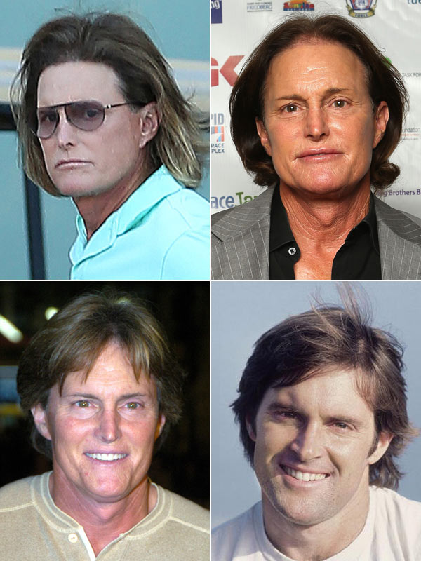 Bruce Jenner Plastic Surgery