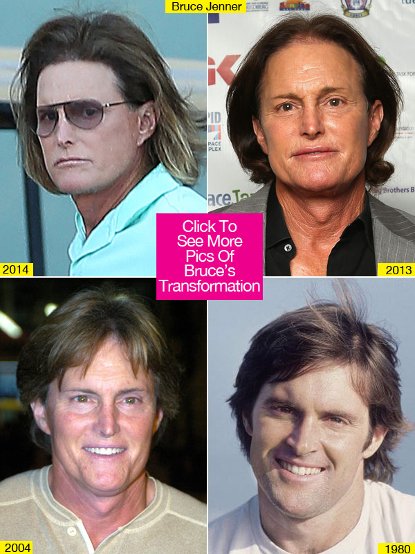 Bruce Jenner Plastic Surgery