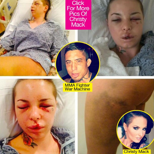 Christy Mack Abuse