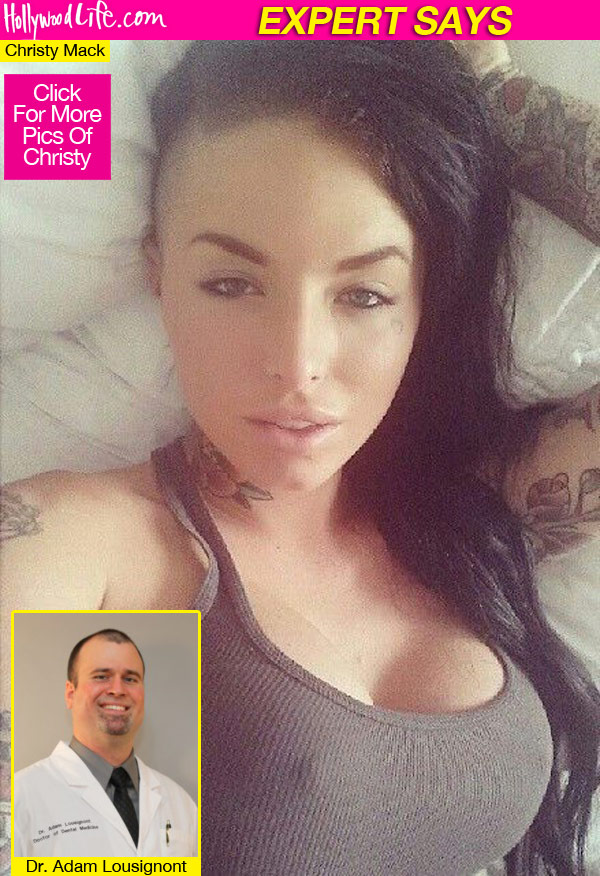 Christy Mack Temporary Teeth