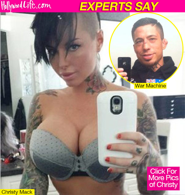 Christy Mack Injuries