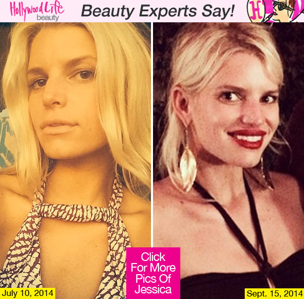 Jessica Simpson Lip Fillers
