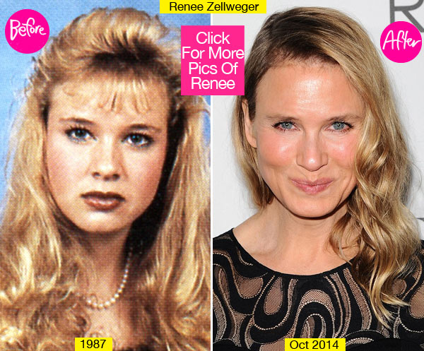 renee zellweger before after