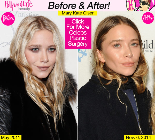 Mary Kate Olsen Face