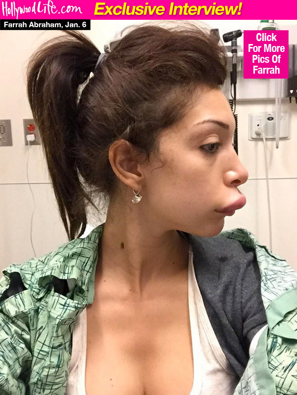 Farrah Abraham Botched Surgery