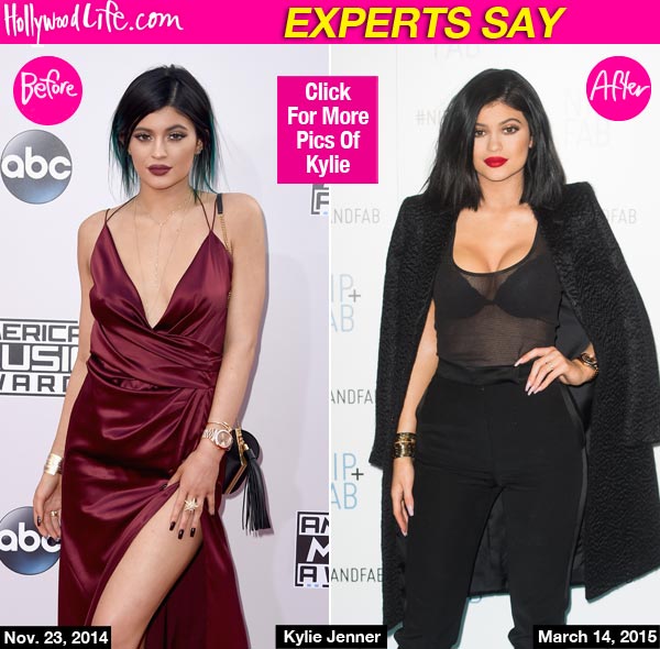 Kylie Jenner Breast Implants