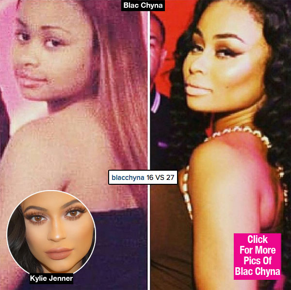 Blac Chyna Plastic Surgery