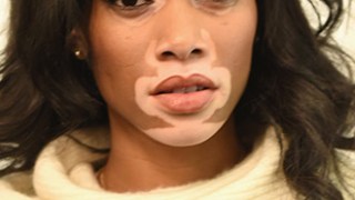 Winnie Harlow Celebrity Profile