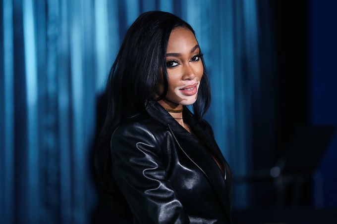 Winnie Harlow