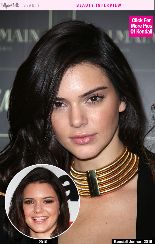 Kendall Jenner Acne