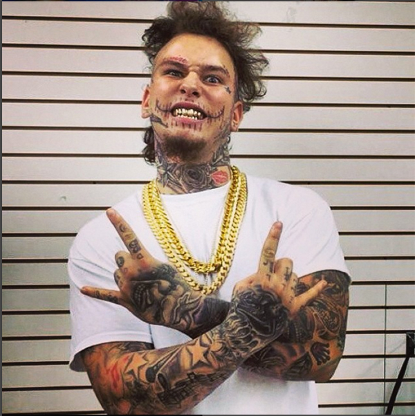 Who Is Stitches