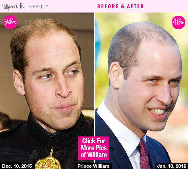 Prince Williams Hair