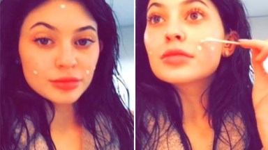 Kylie Jenner Pimple Cream