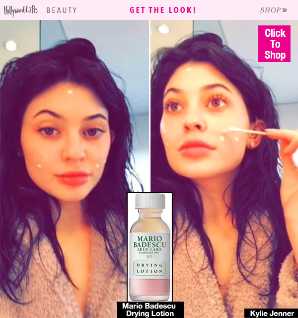 Kylie Jenner Pimple Cream