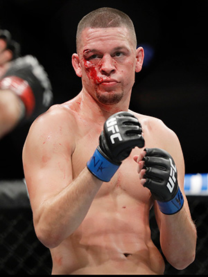 Nate Diaz