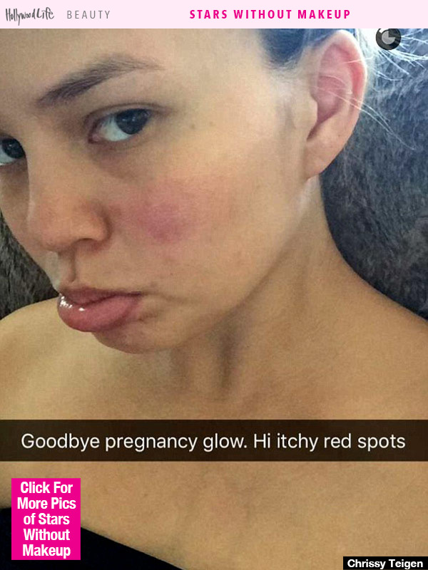 Chrissy Teigen Without Makeup