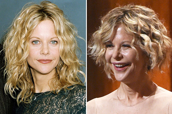 Meg Ryan Plastic Surgery