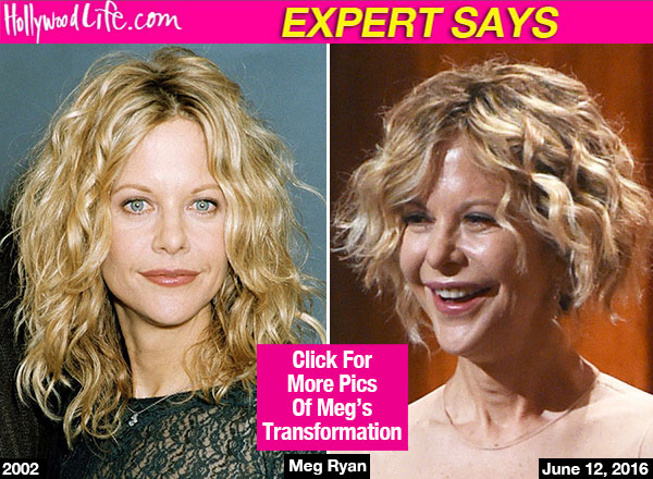 Meg Ryan Plastic Surgery