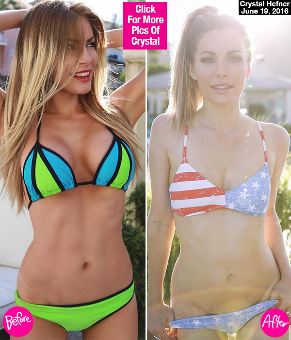 Crystal Hefner Removed Breast Implants