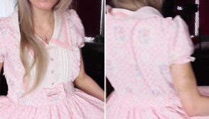 Marina Joyce Bruises