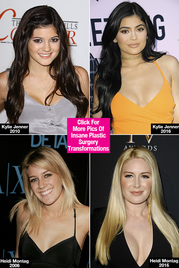 Celebrity Plastic Surgery Transformations