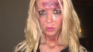 Tara Reid Bruised Face