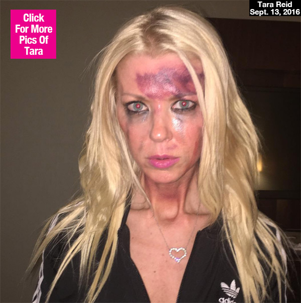 Tara Reid Bruised Face
