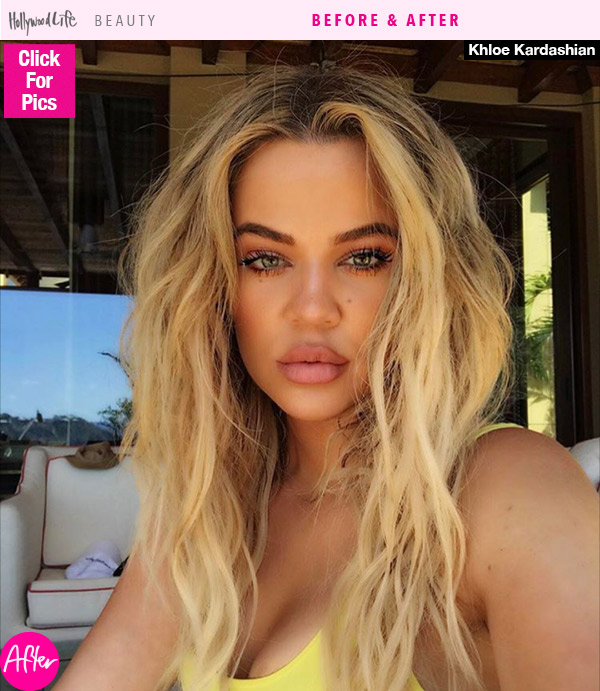 Khloe Kardashian Huge Lips
