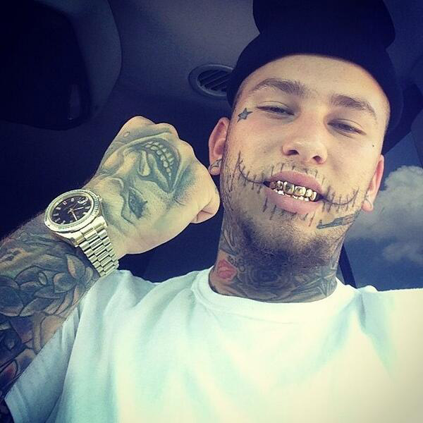 Stitches Pics