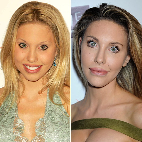 Chloe Lattanzi Plastic Surgery