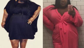 Gabourey Sidibe Surgery