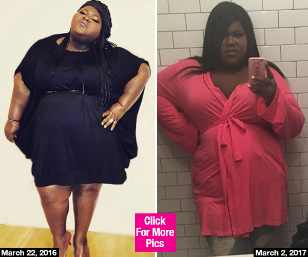 Gabourey Sidibe Surgery