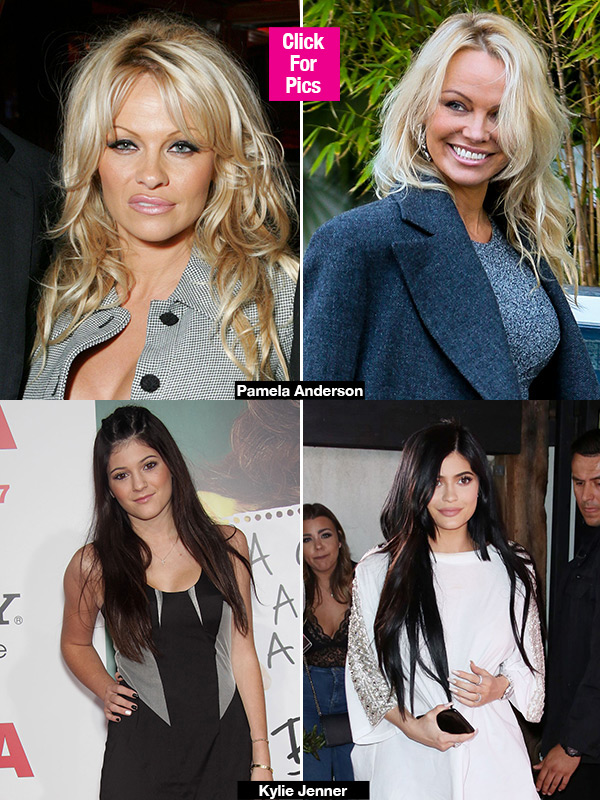 Stars Who Had Extreme Makeovers