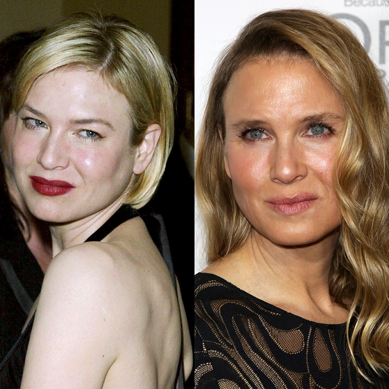 Renee-Zellweger-face-change-