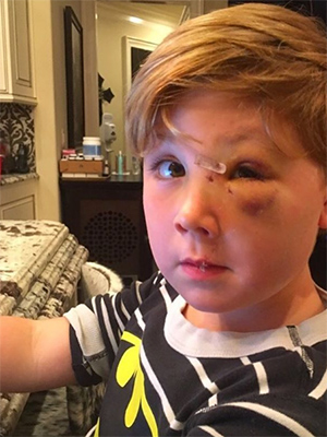 Kim Zolciak's son's dog bite