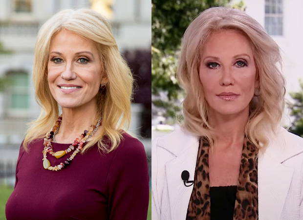 Kellyanne Conway plastic surgery