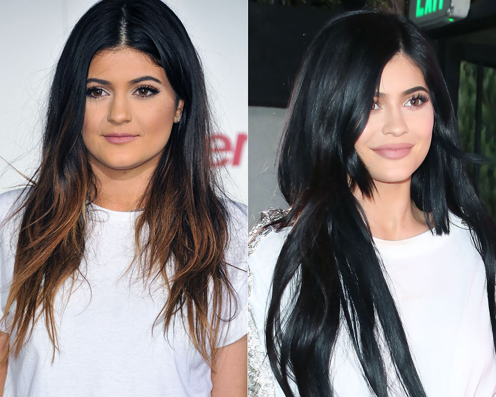 kylie-jenner-lip-fillers-shutterstock-1